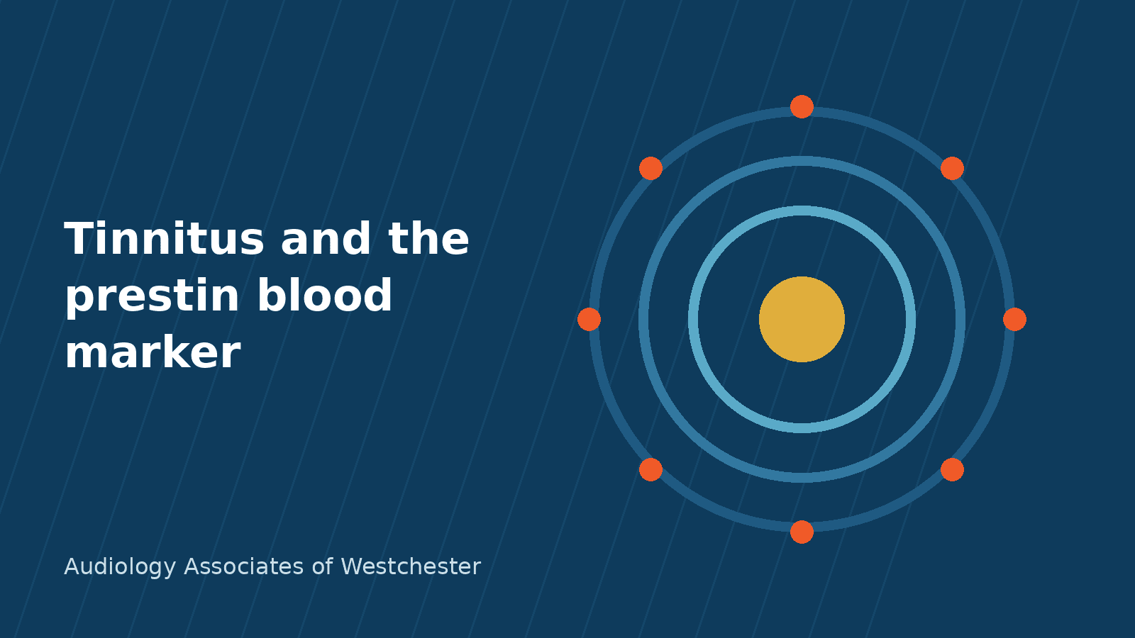 Diagram of a cochlear outer hair cell with the motor protein prestin, illustrating tinnitus research in Westchester