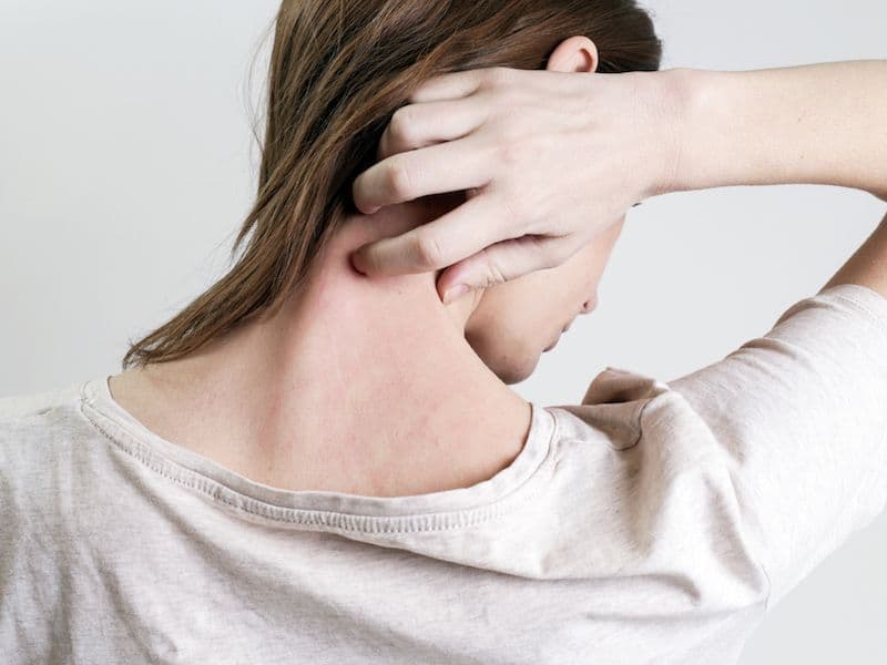 Psoriasis Affects More Than Your Skin